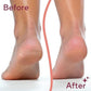 Electric Foot Pedicure Tool