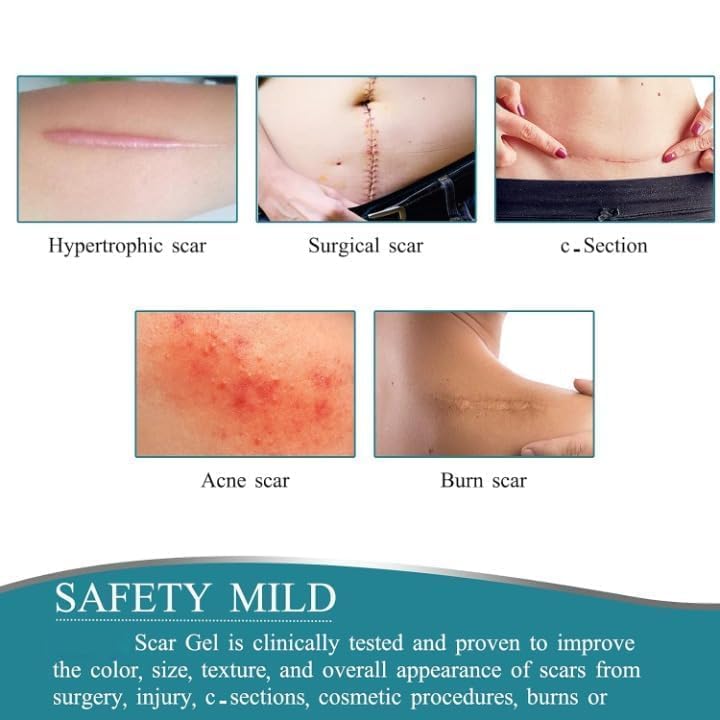 Painless Silicone Scar Removal Tape ( Buy 1 Get 1 Free )