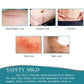 Painless Silicone Scar Removal Tape ( Buy 1 Get 1 Free )